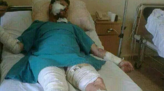 الدكتور الشيخ حسين عطوي بعد اصابته