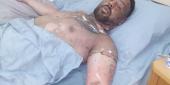 محمد بدر عتمه قبل تعرضه للحروق